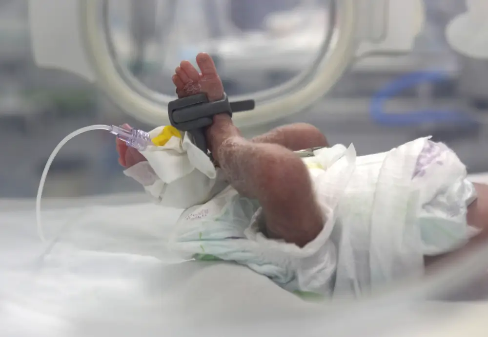 Recién nacido bajo seguimiento en la unidad de cuidados intensivos neonatales apoyada por MSF en el hospital Nasser,en Gaza.