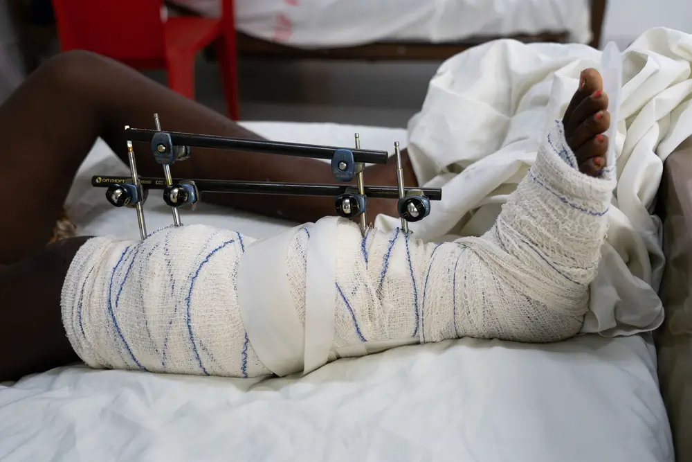 Mujeres hospitalizadas en el hospital de MSF en Tabarre, Puerto Príncipe, durante la ola de violencia que azotó la capital de Haití en febrero y marzo de 2024.