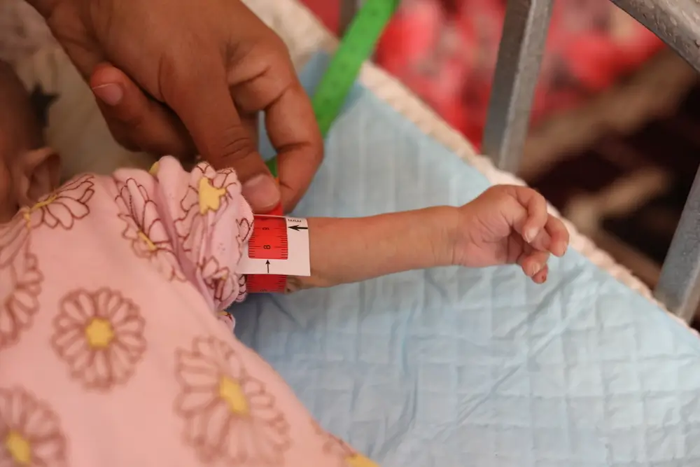 Una niña de 5 meses tratada por desnutrición aguda grave. Su madre la llevó al hospital Nasser, apoyado por MSF, en Jan Yunis para que la trataran de gastroenteritis, allí detectaron que estaba gravemente desnutrida. Fotografía tomada el 1 de mayo.