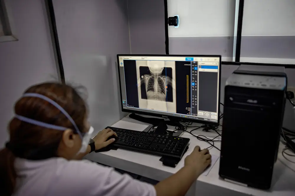Una trabajadora de MSF procesa una radiografía de tórax en uno de los centros de detección activa de tuberculosis de MSF en Tondo, Manila.