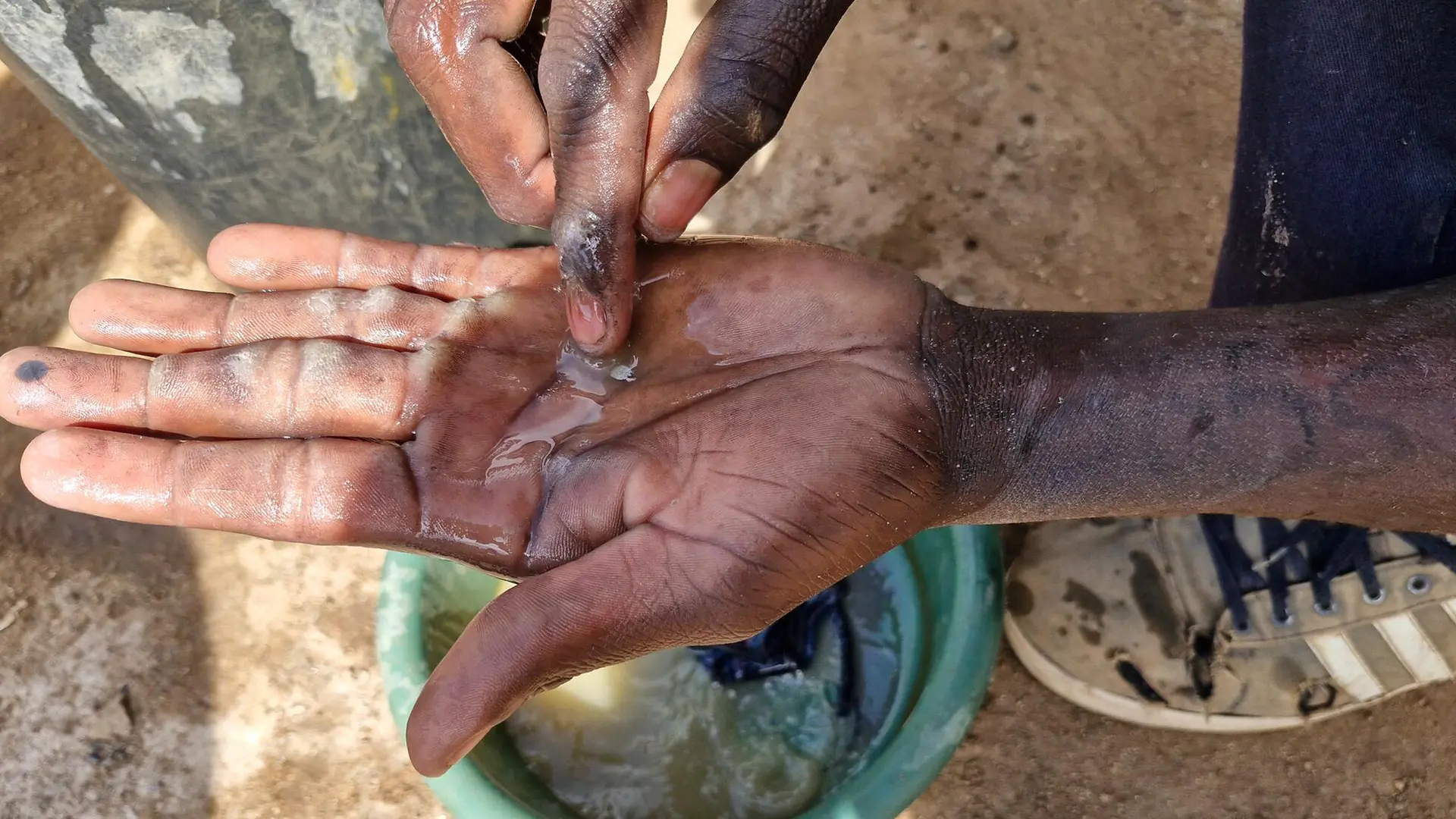 El mercurio se utiliza para extraer oro del mineral. Una vez finalizada la separación, el oro está listo para la venta. Los compradores suelen esperar en la mina para comprar directamente a los mineros.