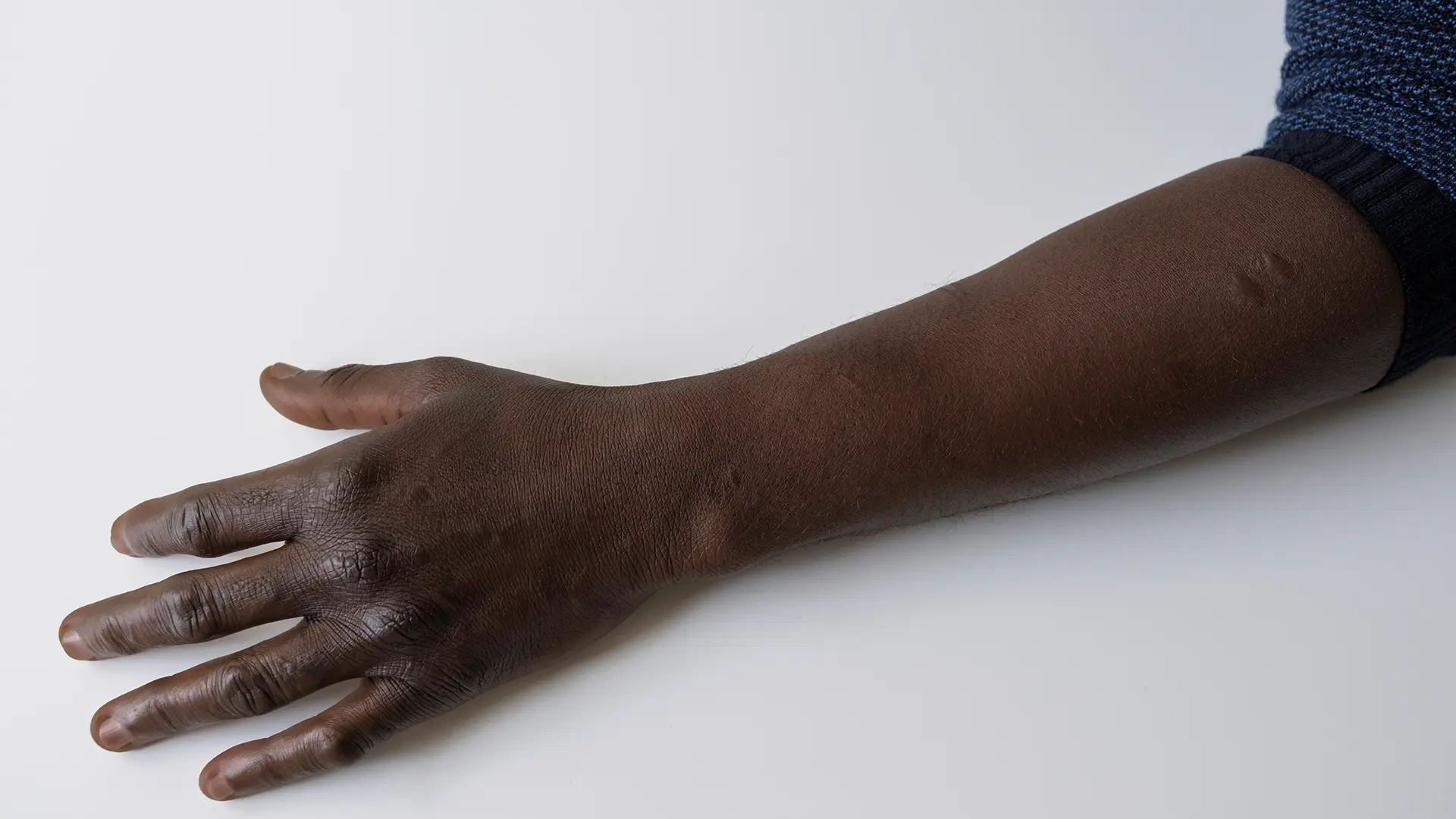 Maka lleva las marcas del viaje en su cuerpo.Un brazo con cicatrices de tortura, aunque no las peores. Maka ha sufrido profundamente, en todas las formas en que un ser humano puede sufrir.