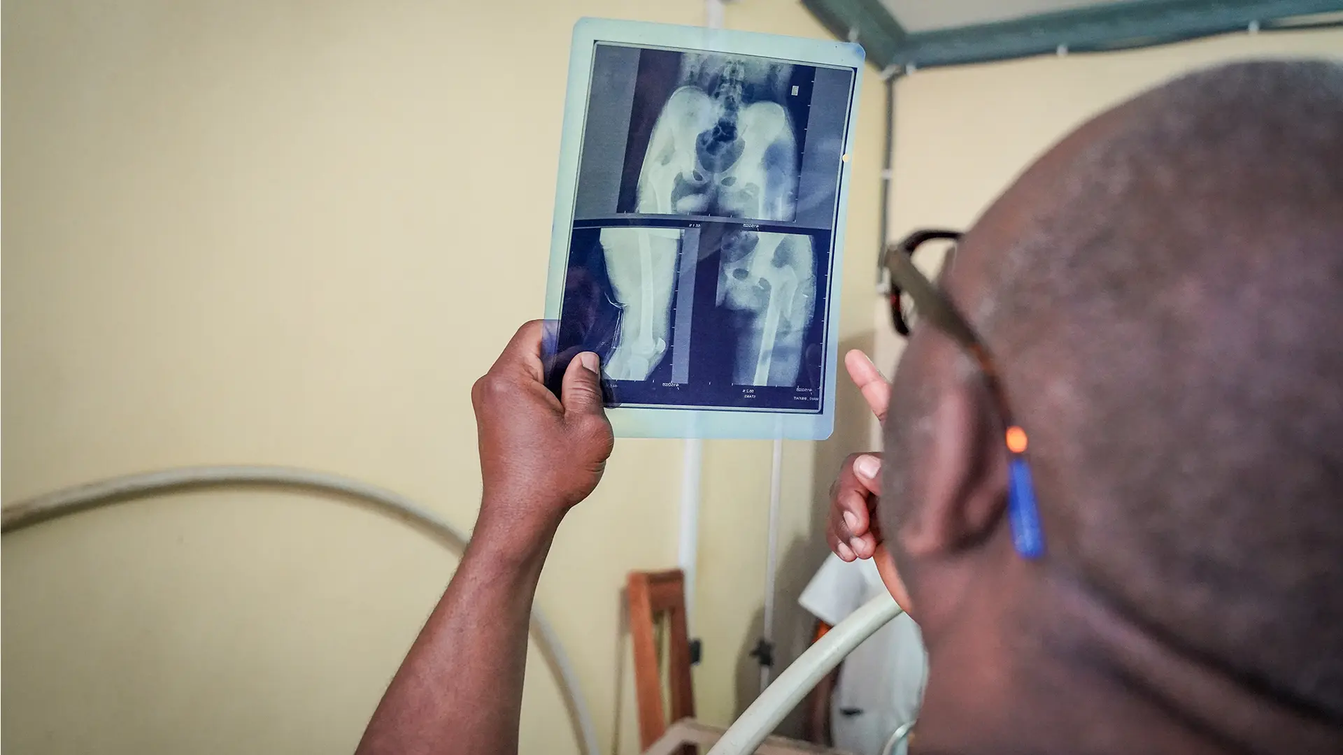 Un médico examina las radiografías de una joven víctima de la violencia armada. Clínica Salama, Bunia, República Democrática del Congo.