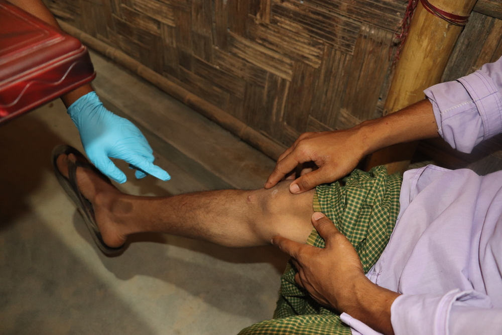 MSF responde al brote de sarna en los campos para refugiados en Bangladesh