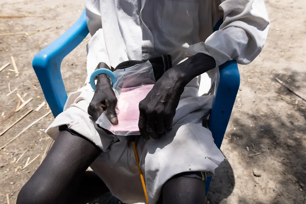 MSF atiende a pacientes con desnutrición, TB/VIH en en Leer, estado de Unity. Sudán del Sur