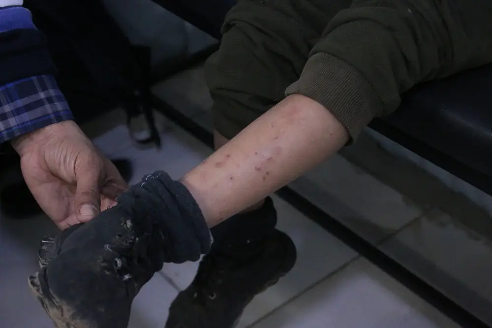 Un niño palestino con sarna recibe tratamiento médico en la clínica de atención primaria de MSF Mawasi Rafah, al sur de la Franja de Gaza, Palestina.