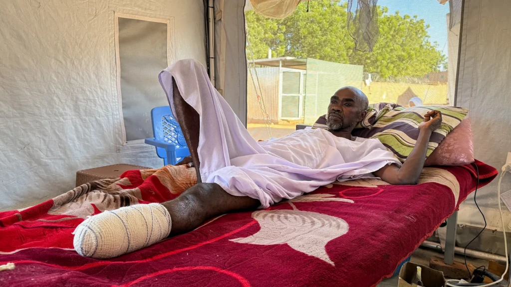 IA recibió un disparo en la pierna durante el tiroteo en El Fasher. Su hermano le hizo un torniquete con cartón y lo llevó en una carreta tirada por un burro hasta Tawila. Cuando llegó al hospital, los médicos tuvieron que amputarle parte de la pierna.