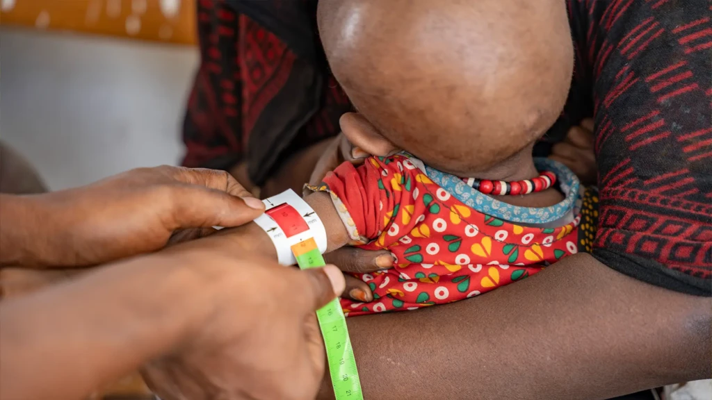 El equipo de MSF realiza el MUAC de un niño en el puesto de salud.